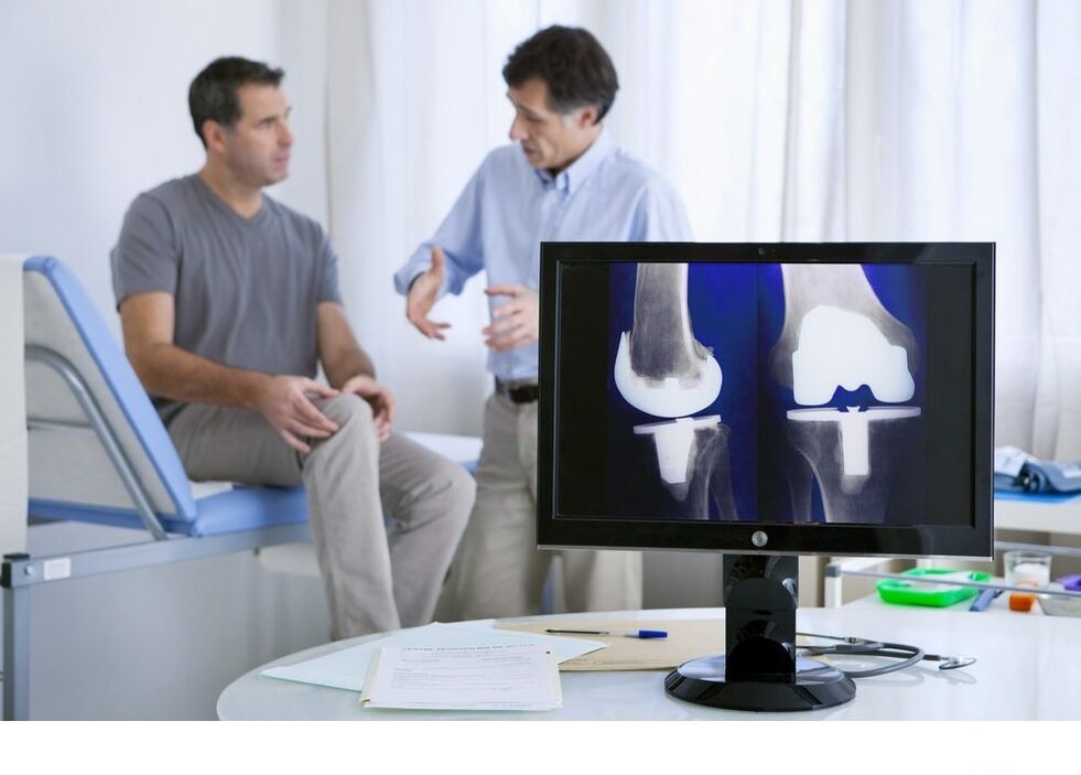 artróza kolenného kĺbu na obrázku X -Ray